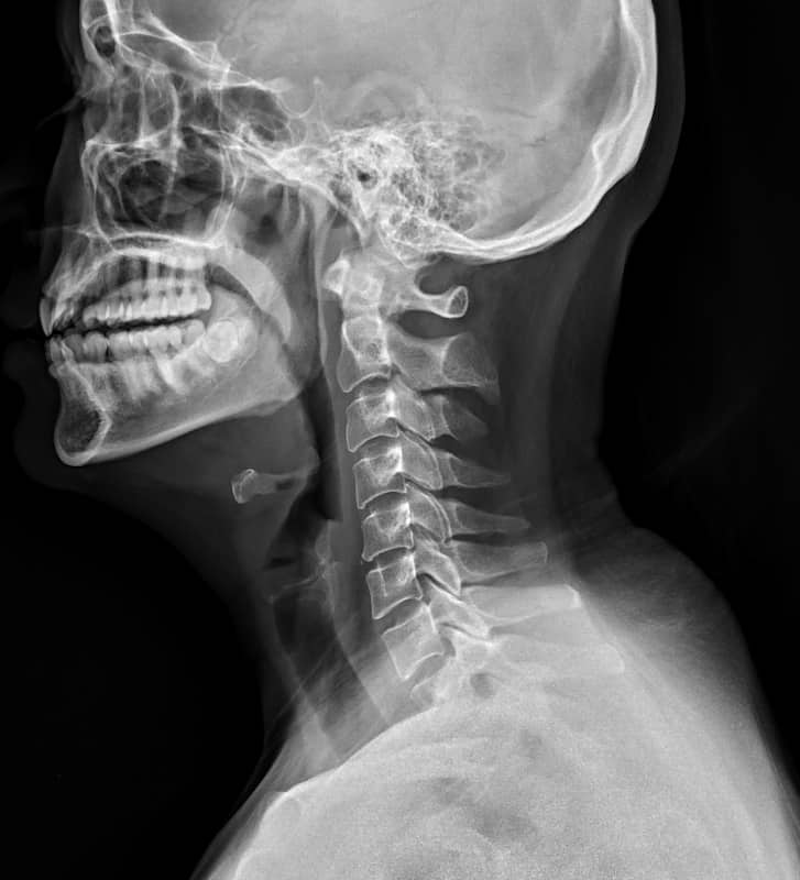 X-ray of a human - head, neck and top of shoulders.