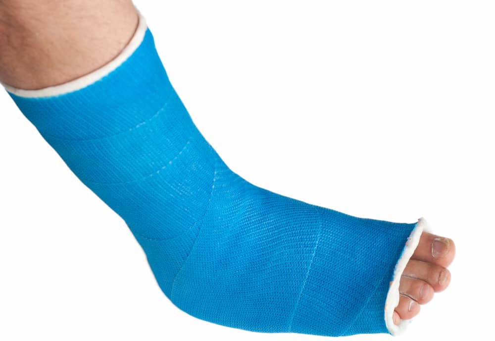foot in a blue ankle cast.